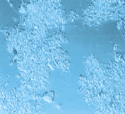 Pure Oxygen Aeration